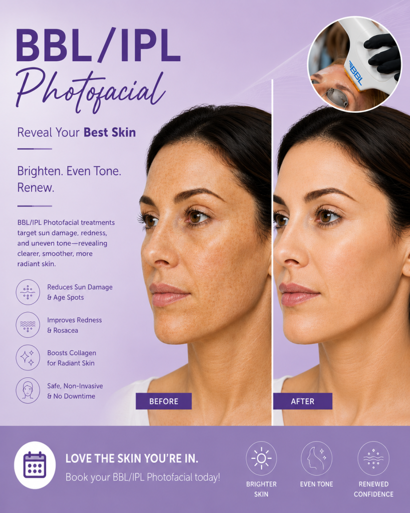 BBL/IPL Photofacial